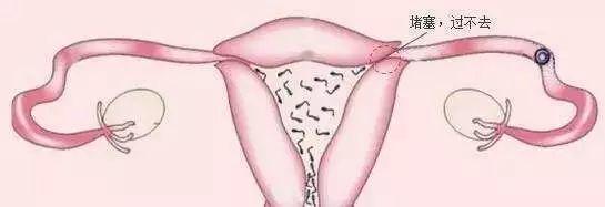 ���ѹܲ�ͨ��Ӱ������������