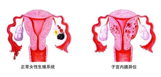 ����ӹ���Ĥ��λ֢�Ĳ�������Щ