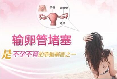 ��Щ���Ƽ������׵������ѹܶ���