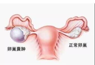 �ѳ�����Ϊʲô�ᵼ��Ů�Բ���